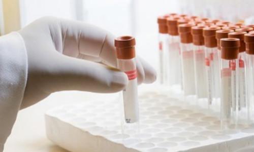 5.9-8.1.jpg 5.9-8.1.jpg